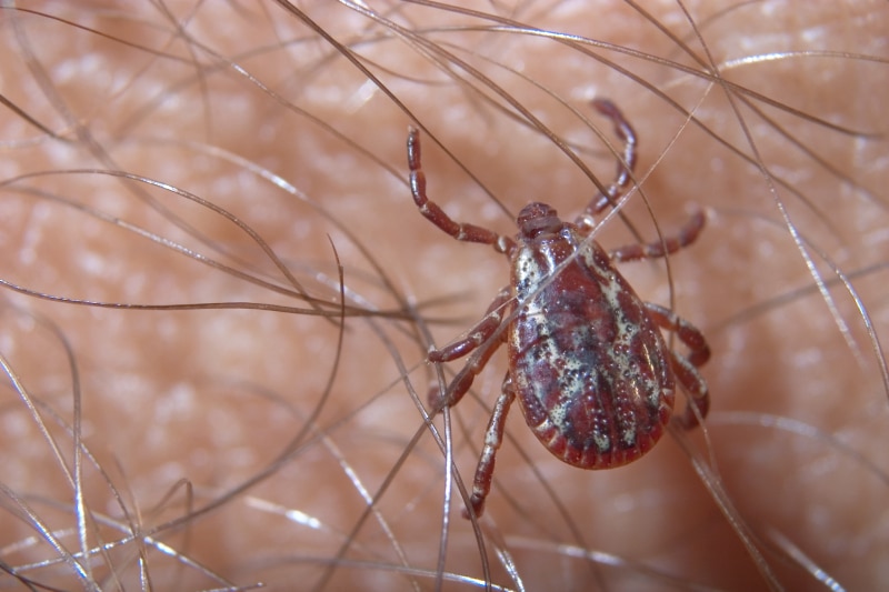 Close up of an American dog tick crawling across hairy skin